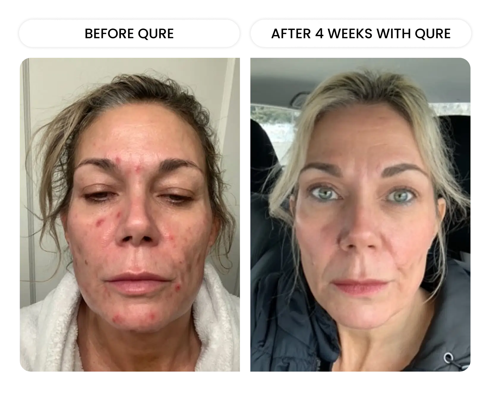 Q-Rejuvalight Pro-Facewear - Image 10