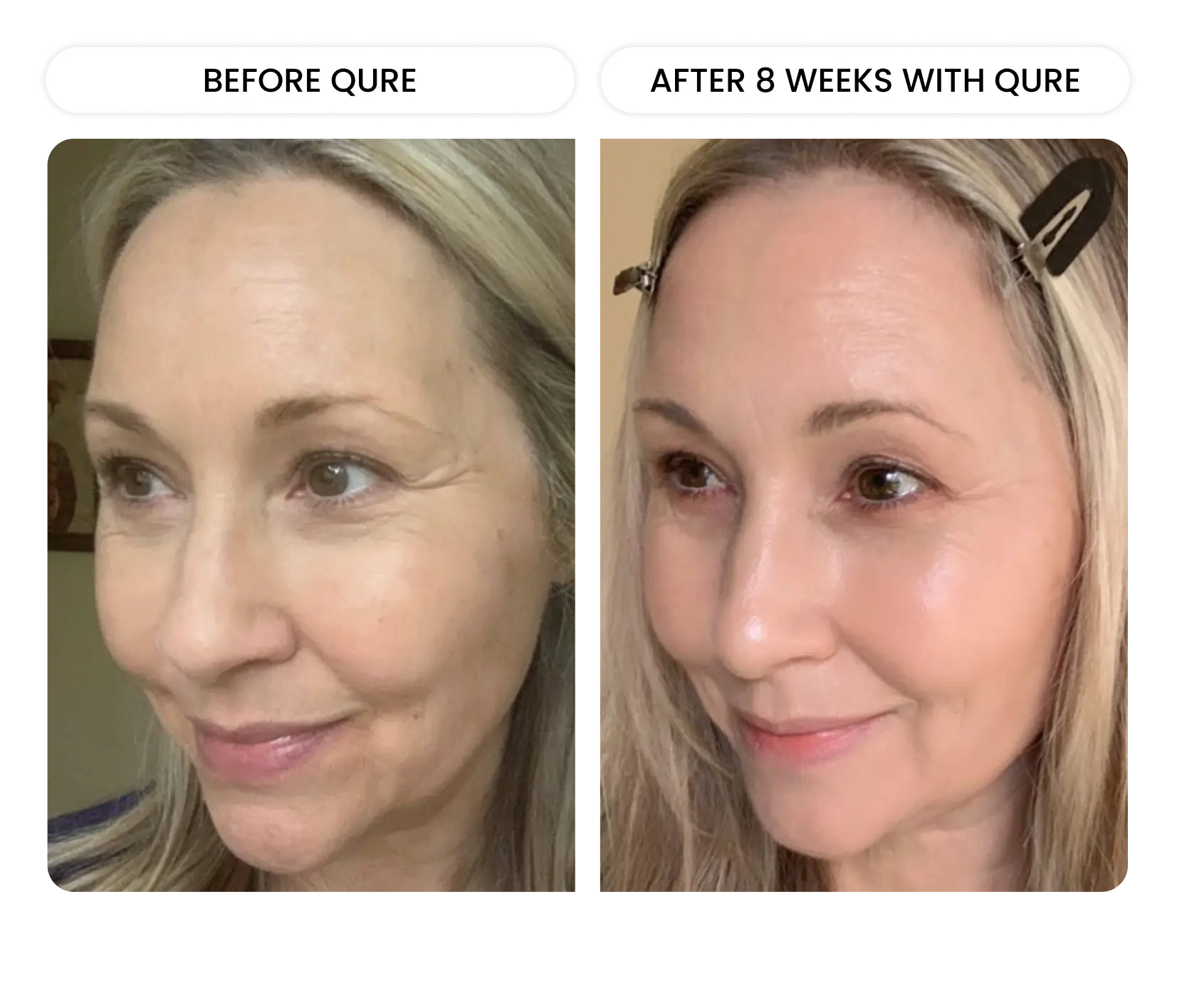 Q-Rejuvalight Pro-Facewear - Image 9